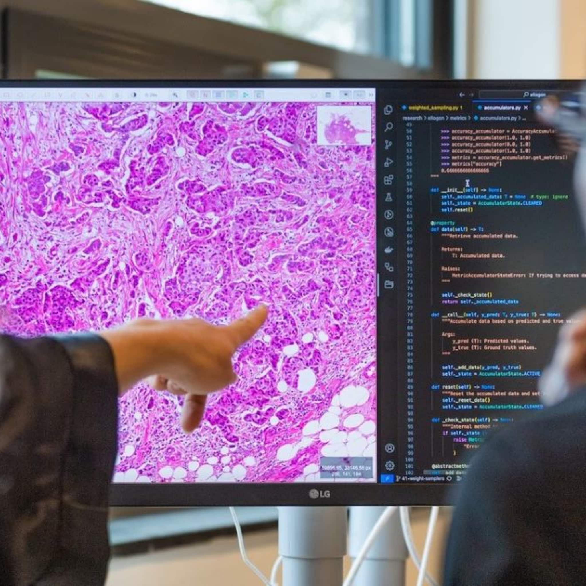 hoe ellogon met 1 miljoen euro de zorg helpt met ai toepassingen