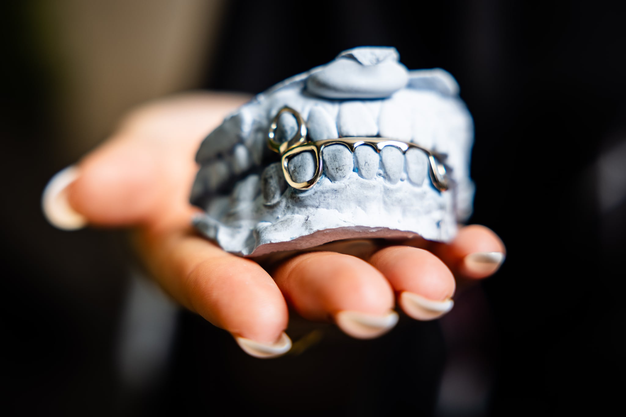 Een grill voor je tanden. Tessa maakt ze handmatig in haar vrije tijd. Foto: Jeffrey Groeneweg Een grill voor je tanden. Tessa maakt ze handmatig in haar vrije tijd. Foto: Jeffrey Groeneweg